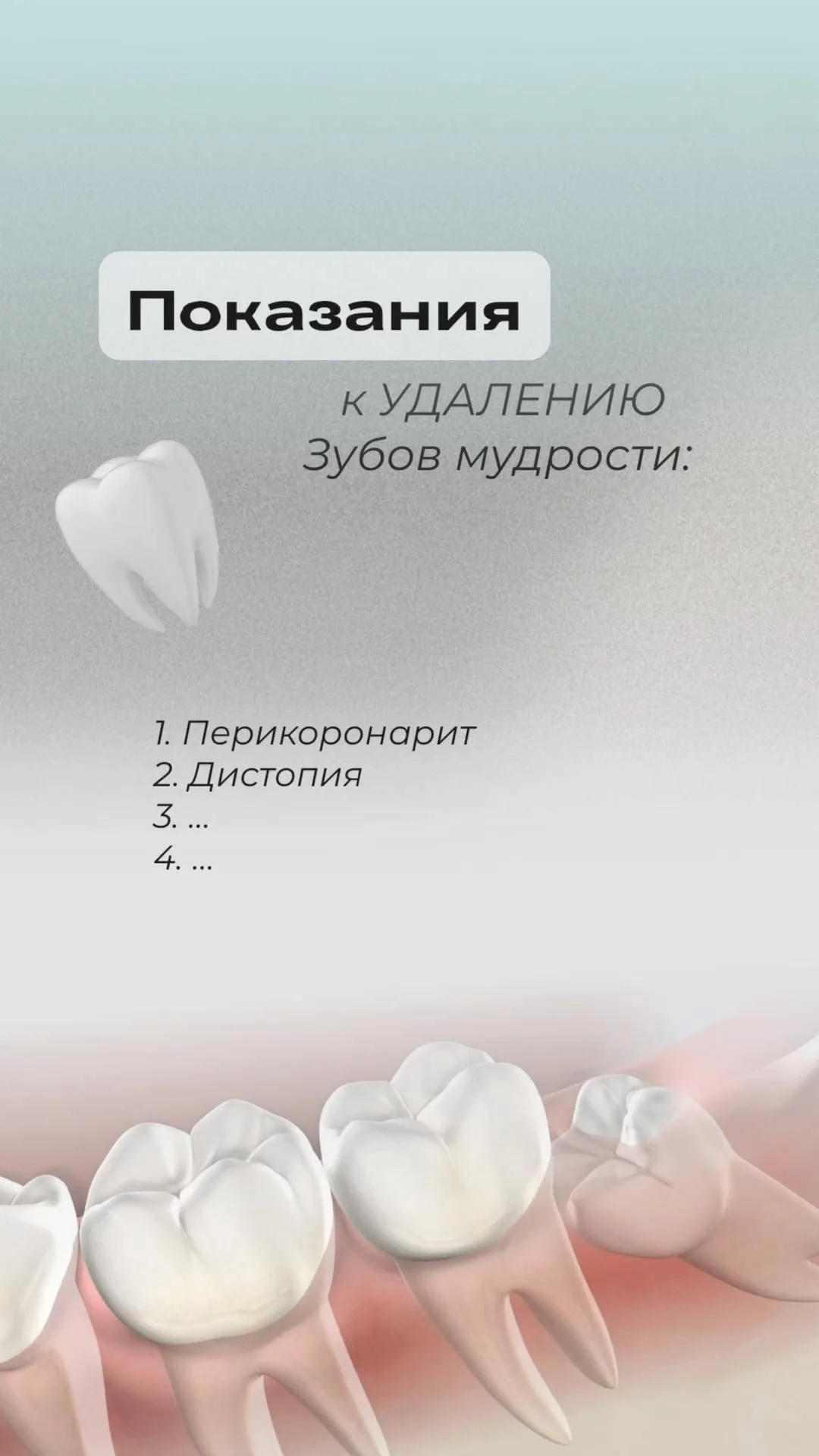 Stories me, please! | Удаление зубов мудрости, Сторис для стоматологии, Стоматологические факты